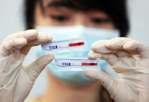 hiv-test, malattie