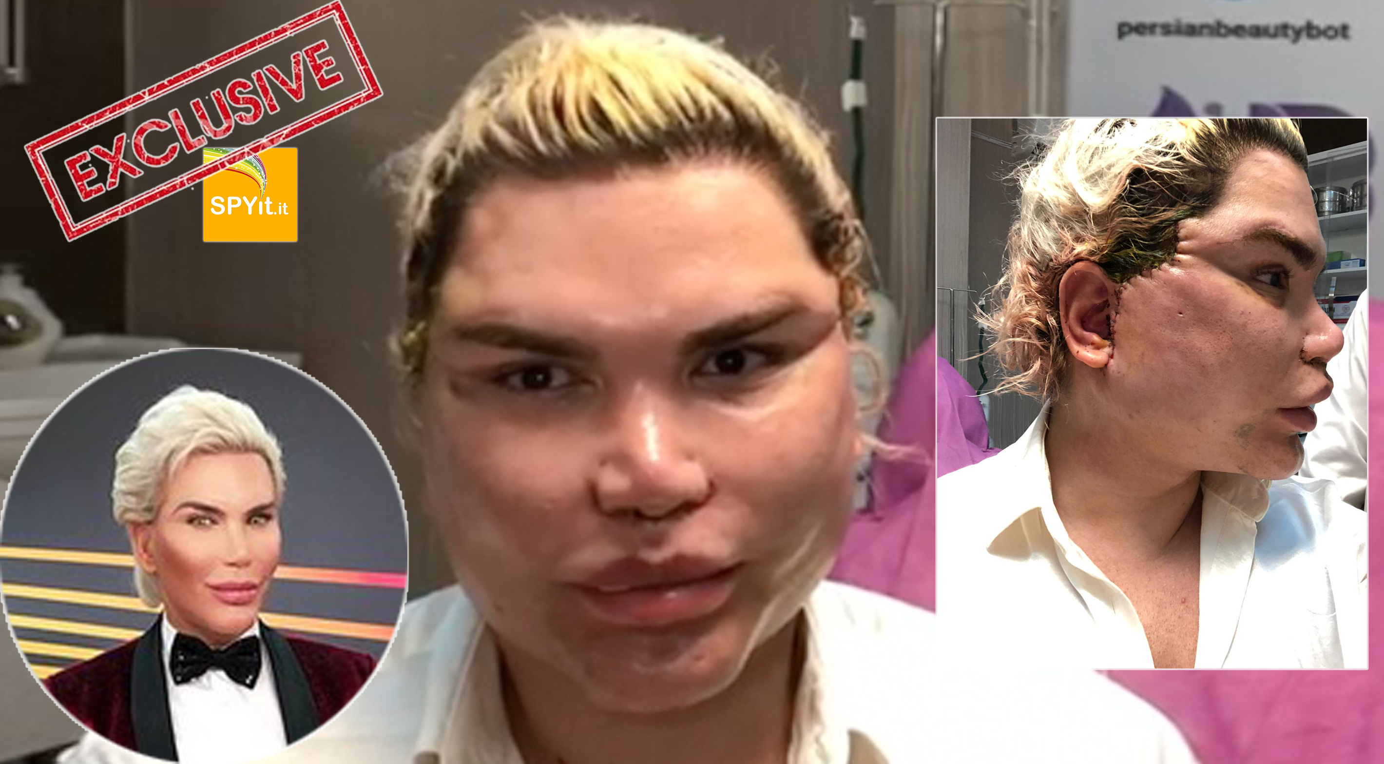 rodrigo alves ken umano 2